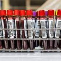 Ученые научились преобразовывать кровь в нервные клетки