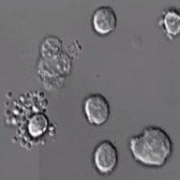 Ученые опубликовали видео смерти лейкоцита